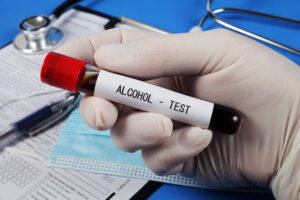 What Is A Blood Alcohol Test & What Happens During One?￼